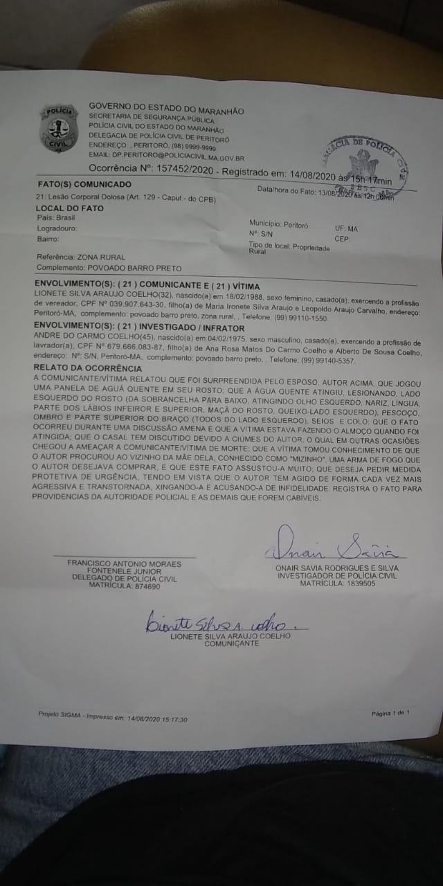 A vereadora de Peritoró, Dudu Coelho, ficou com queimaduras grave no corpo após seu marido, o ex-vereador André Coelho, ter jogado um papeiro com água quente em seu rosto e peito. O caso ocorreu na quinta-feira (13) após o homem ter supostamente descoberto uma traição da esposa.