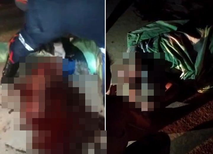 Homem tem perna dilacerada em acidente na cidade de Coroatá-MA